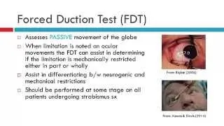 Forced Duction Test & Force Generation Test