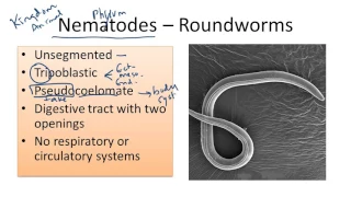 Nematodes; Roundworms