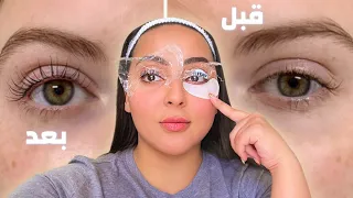 عملت أخطر اجراء تجميل في البيت 😱 والنتيجة خيال 🔥 | بسمة داش