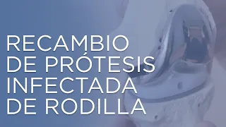 Cirugía de recambio de una prótesis de rodilla infectada