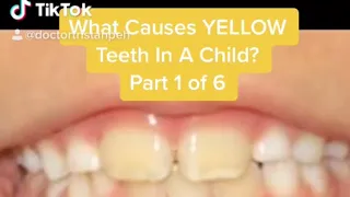 What cause yellow teeth in a child (Part 1 of 6)