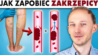 Zakrzepica zagraża zdrowiu i życiu - 17 rad, jak jej uniknąć | Dr Bartek Kulczyński