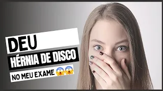 Posso ter hérnia de disco, mesmo não apresentando dor?