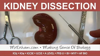 Kidney Dissection - GCSE, A Level, IB