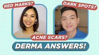 How to treat ACNE SCARS & ACNE MARKS? Dermatologist Answers! (Filipino) | Jan Angelo