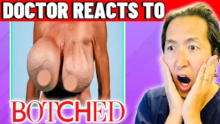 Plastic Surgeon Reacts to BOTCHED: Breast Implants Gone HORRIBLY WRONG!