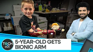 Meet the youngest person to receive a bionic arm | Tech It Out