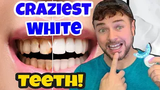 Get The CRAZIEST SUPER WHITE TEETH Fast | Chris Gibson