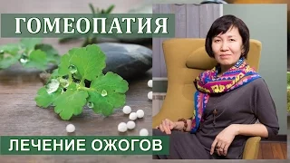 О Гомеопатии. Лечение ожогов гомеопатическими препаратами.