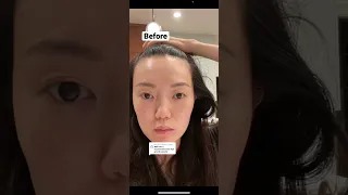 These were my results after 1 month of using my Maya Chia hair growth serum + Nutrafol supplements