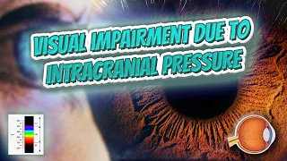 Visual impairment due to intracranial pressure (Your EYEBALLS) 👁️👁️💉😳💊🔊💯✅