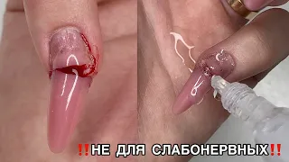 18+ СОРВАЛА НОГОТЬ🥲ТРЕЩИНА НА НОГТЕ