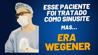 Doença de WEGENER (GPA) que começou com SINUSITE |Dr Bruno Taguchi|