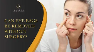 Can Eye Bags Be Removed Without Surgery? | Radium Medical Aesthetics