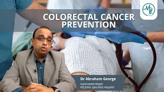 Colorectal Cancer Prevention | Dr Abraham George (Gastroenterologist)