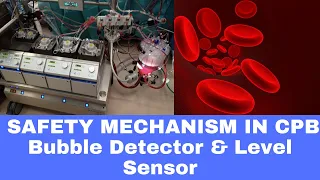 Safety Mechanism in CPB ( Level sensor & Bubble Detector)