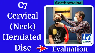 C7 Cervical (neck) Herniated Disc Evaluation