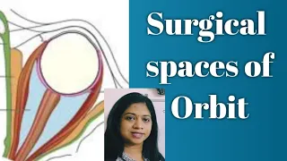 Surgical spaces of Orbit/ Anatomy of Orbit/ Subperiosteal space/ Peripheral space/central space