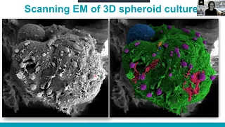 Diverse plasma membrane protrusions act as platforms for EV shedding by Kirsi Rilla