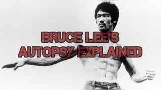 Famous Autopsies- Bruce Lee