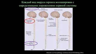 Герпетический энцефалит и другие поражения нервной системы, вызванные альфа-герпес-вирусами