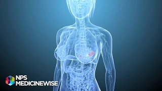 Breast tenderness and  hormone replacement therapy (HRT) - from Tonic TV