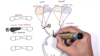 Visual Pathway and Lesions