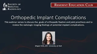 SSR Resident Education Club - Orthopedic Implant Complications - Nov 17, 2021