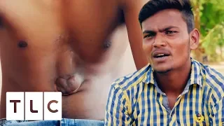 Indian Teenager Lives With His Heart Outside Of His Chest | Body Bizarre