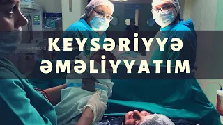 🔴KEYSERİYYE EMELİYYATİM  (KEYSƏRİYYƏ -QEYSƏRİYYƏ  ƏMƏLİYYATIM)