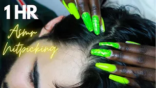 [ASMR] Allzoomed Nitpicking Whiteheads | Scalp Check-Up | Light Scratching With Nails.