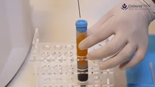 Cellenis PRP preparation process