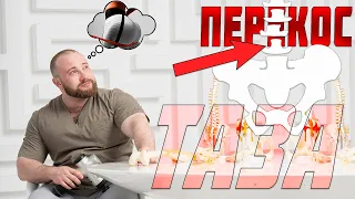 Перекос таза: проблемы и решения | Доктор Королёв