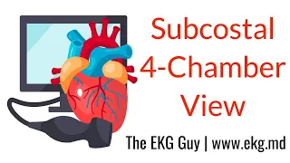 Subcostal 4-Chamber View - ECHO Course l The EKG Guy - www.ekg.md