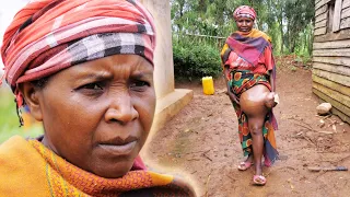 A Mother Of Nine With Giant Leg Tumor Shocked Everyone : EXTRAORDINARY PEOPLE