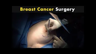 Breast Cancer Treatment | How Breast Cancer Surgery Is Performed?