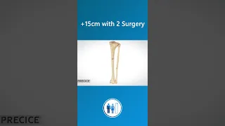 How is limb lengthening surgery performed with Precice 2?