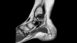 Ankle MRI anatomy