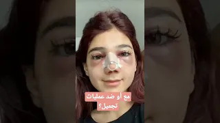 نارين بيوتي قبل وبعد عملية التجميل 🤯