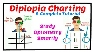 Diplopia Charting - A Complete Tutorial.