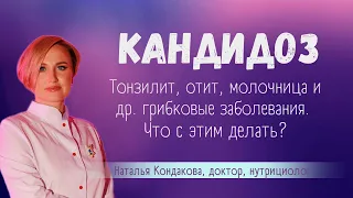 Как КАНДИДОЗ влияет на тонзилит, молочницу и даже камни в организме.