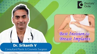 BREAST AUGMENTATION |BREAST IMPLANT INCISIONS #breastaugmentation -Dr. Srikanth V | Doctors' Circle