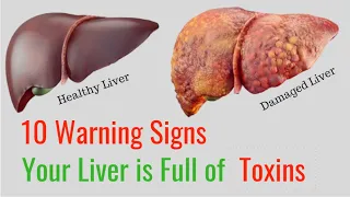 10 Warning Signs Your Liver is Full of Toxins
