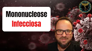Síndrome da Mononucleose Infecciosa (doença do beijo) - Renato Cassol Médico Infectologista