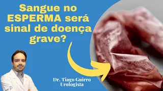 Sangue no ESPERMA será sinal de doença grave? Urologista Dr Tiago Guirro