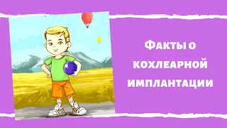 Интересные факты о кохлеарной имплантации