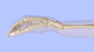 Closed Reduction of a Distal Radius Fracture