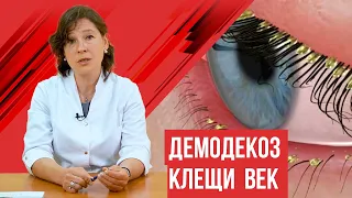 Демодекоз век, когда нужно лечение и каким оно должно быть?