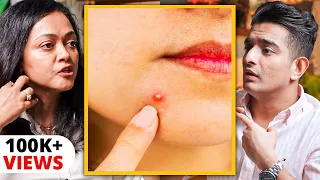 CURE YOUR PIMPLE In 1 Hour - Medically Backed Method Explained By Dermatologist