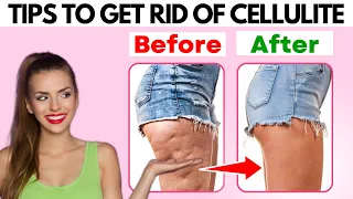 Reducing Cellulite on Thighs, Legs, and Butt: Home Remedies, Workouts, Creams, and More